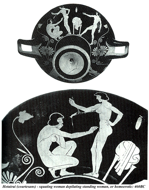 Hetairai- squating depilation of standing or homoerotic 460BC